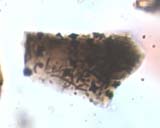 Slag