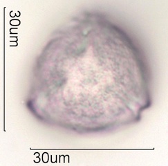 Sweet trefoil (Trigonella caerulea ) Pollen Under the Microscope