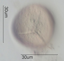 Trilete Pollen
