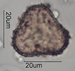 Maidenhair Fern Spore Under the Microscope