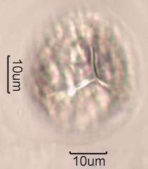 Trilete Spore Under the Microscope