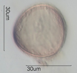 Trilete Spore Under the Microscope