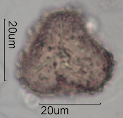 Maidenhair Fern Spore Under the Microscope