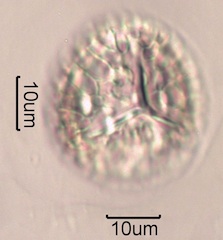 Trilete Spore Under the Microscope