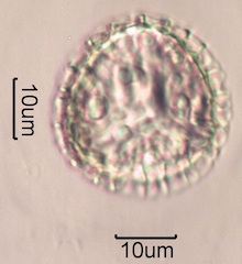 Trilete Spore Under the Microscope
