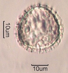 Trilete Spore Under the Microscope