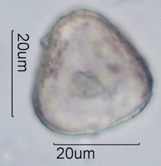 Bracken Fern Spore Under the Microscope
