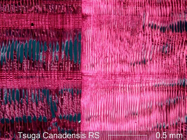 Tsuga Canadensis, Radial-Section