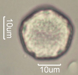 Elm (Ulmus sp.) Pollen under the Microscope