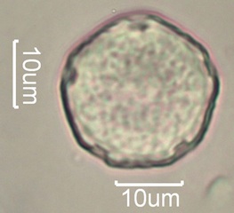Elm (Ulmus sp.) Pollen Under the Microscope