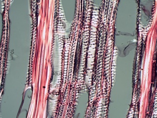 Ulmus thomasii, Radial-Section