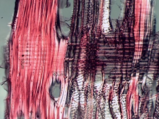 Ulmus thomasii, Radial-Section