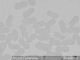 CELANESE Vinyon Cross-Section