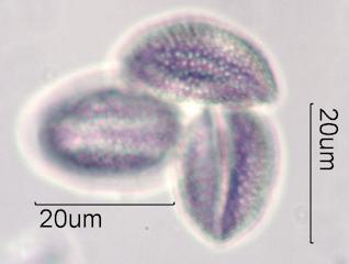 Mexican Fan Palm (Washingtonia robusta) Pollen