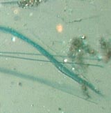 Crocidolite