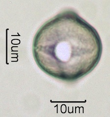 White Clover (Trifolium repens) Pollen