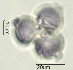 White Clover (Trifolium repens) Pollen
