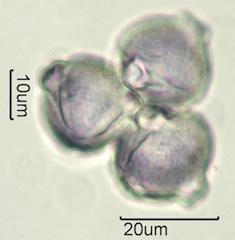 White Clover (Trifolium repens) Pollen