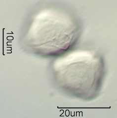 White Clover (Trifolium repens) Pollen