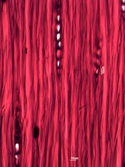 Quercus alba, Tangential-Section
