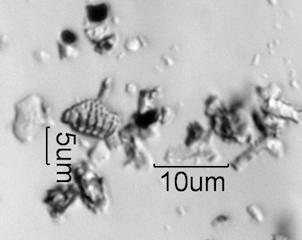 White Rain Particles Under the Microscope