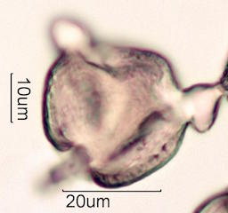 Pollen found in Wililaiki Honey