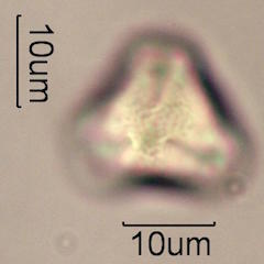 Pollen found in Wililaiki Honey