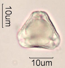 Pollen found in Wililaiki Honey