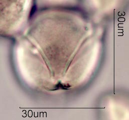 Pollen found in Wililaiki Honey