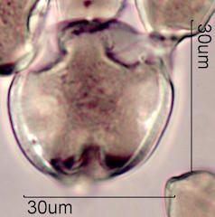 Pollen found in Wililaiki Honey
