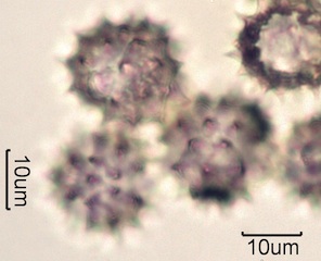 Yarrow Pollen Under the Microscope
