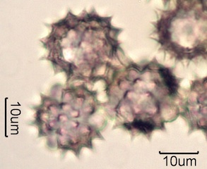 Yarrow Pollen Under the Microscope