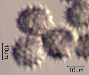 Yarrow Pollen Under the Microscope