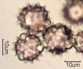 Yarrow Pollen Under the Microscope