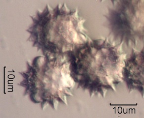Yarrow Pollen Under the Microscope