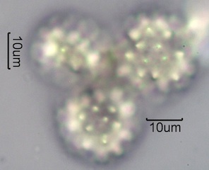 Yarrow Pollen Under the Microscope