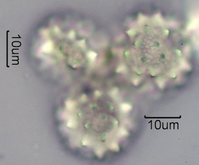 Yarrow Pollen Under the Microscope