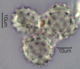 Yarrow Pollen Under the Microscope
