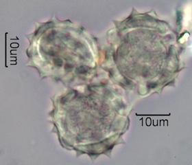 Yarrow Pollen Under the Microscope