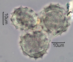 Yarrow Pollen Under the Microscope