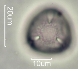 Yellow Clover (Trifolium minus) Pollen