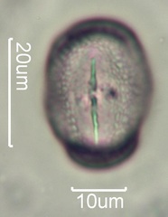 Yellow Clover (Trifolium minus) Pollen