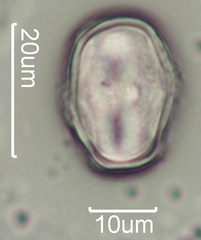 Yellow Clover (Trifolium minus) Pollen