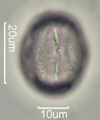 Yellow Clover (Trifolium minus) Pollen