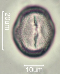 Yellow Clover (Trifolium minus) Pollen