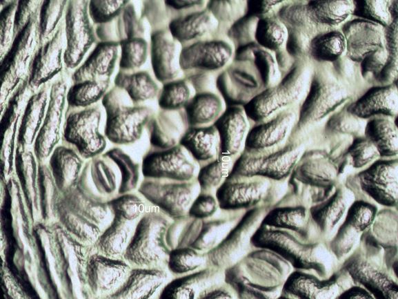 Stomata Under The Microscope