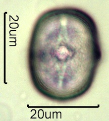 Yellow Sweet Clover Pollen Under the Microscope