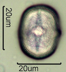 Yellow Sweet Clover Pollen Under the Microscope