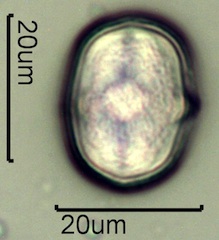 Yellow Sweet Clover Pollen Under the Microscope