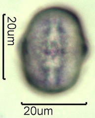 Yellow Sweet Clover Pollen Under the Microscope